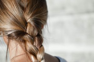 female hair loss due to PCOS